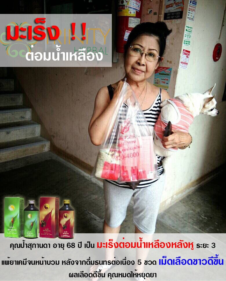 รีวิว สมุนไพรธนทร มะเร็งต่อมน้ำเหลือง