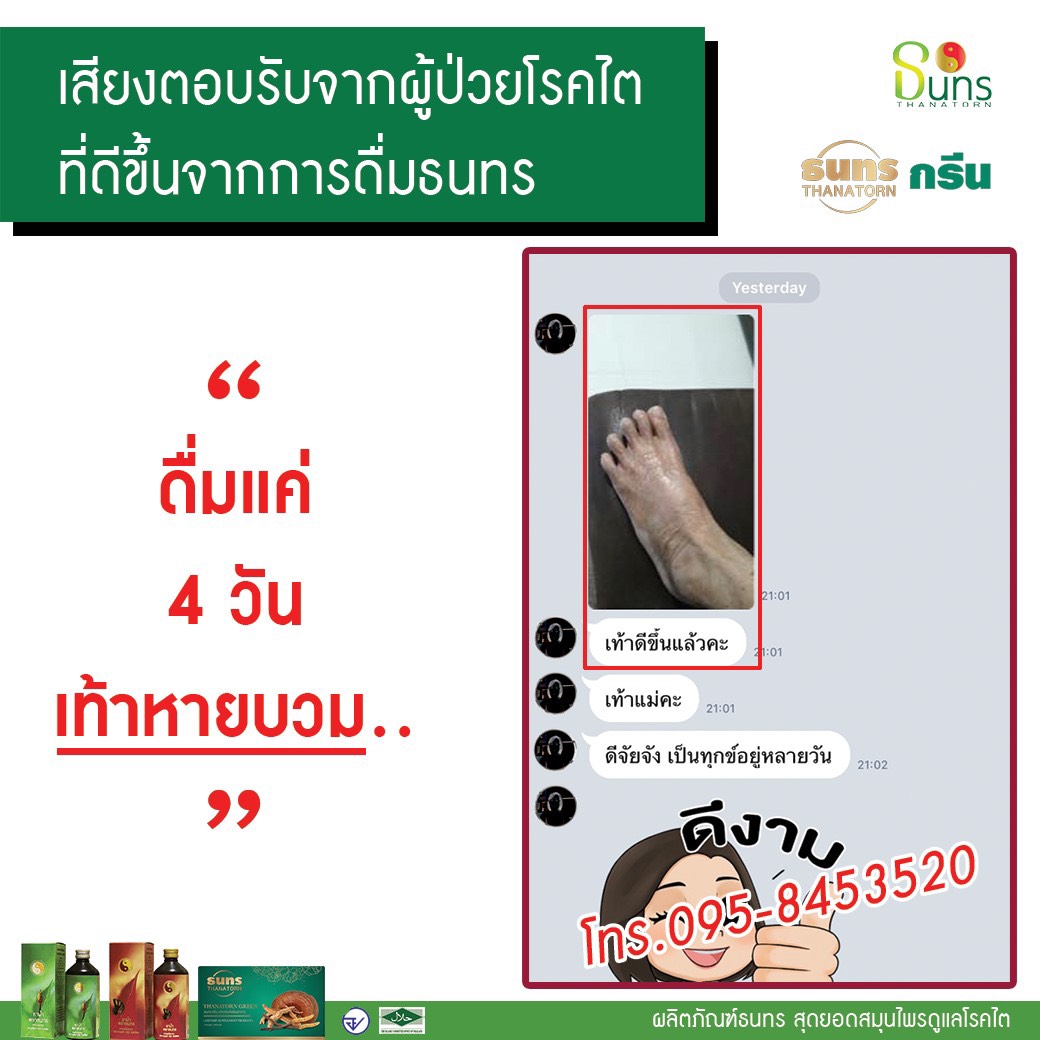 เท้าบวมเพราะเป็นโรคไต