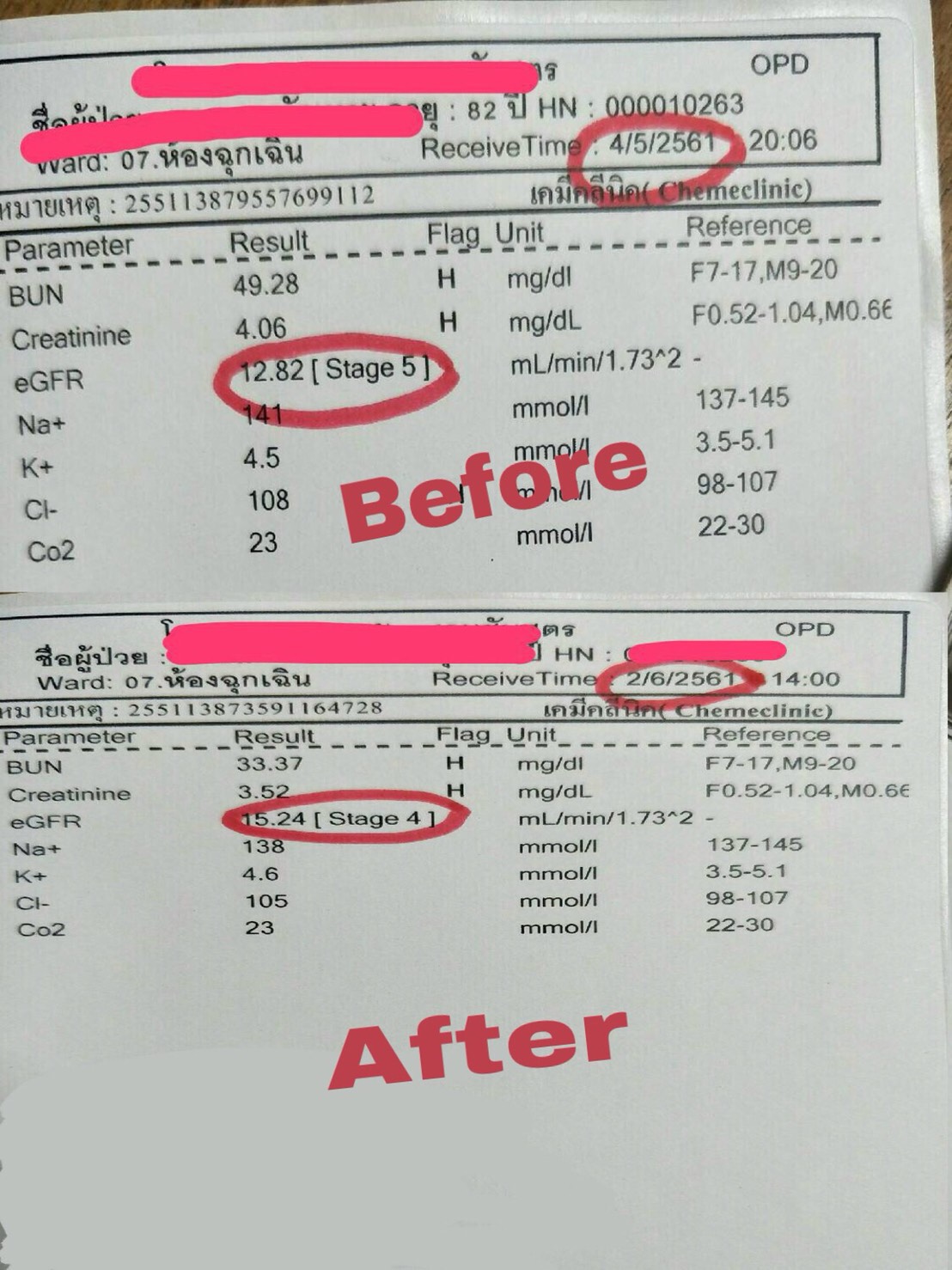 รีวิวสมุนไพรธนทร โรคไต ผลตรวจ