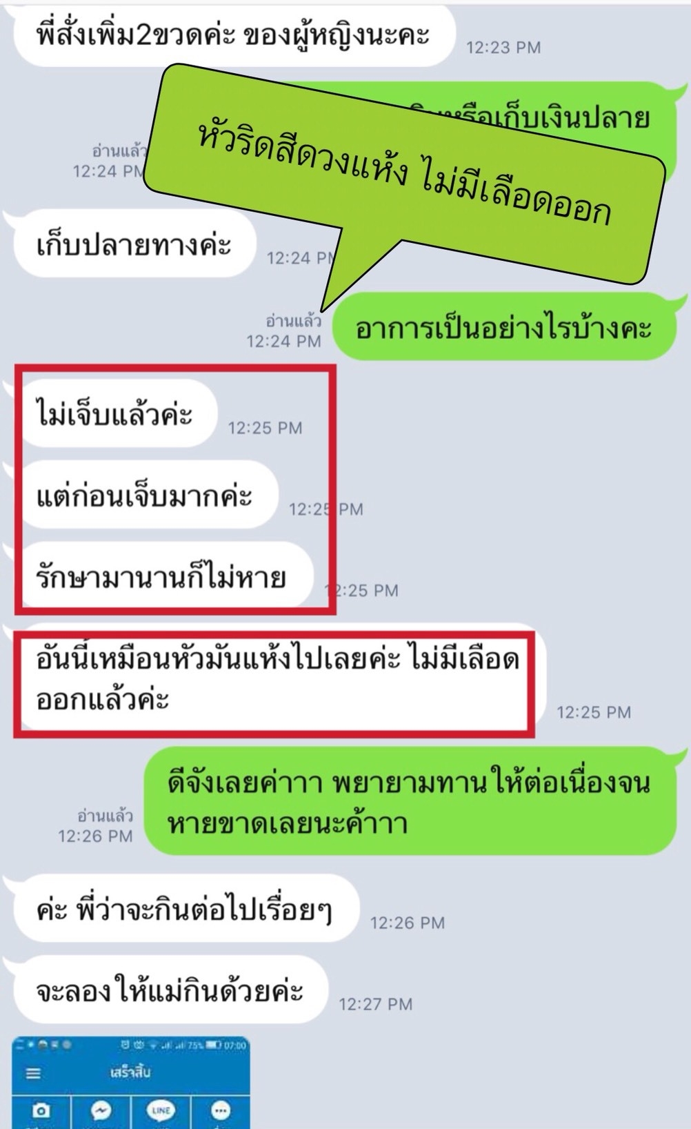 สมุนไพรธนทร รักษาโรคริดสีดวง