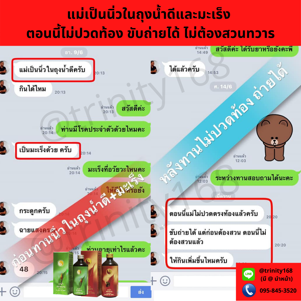 สลายนิ่วในไต ราคา