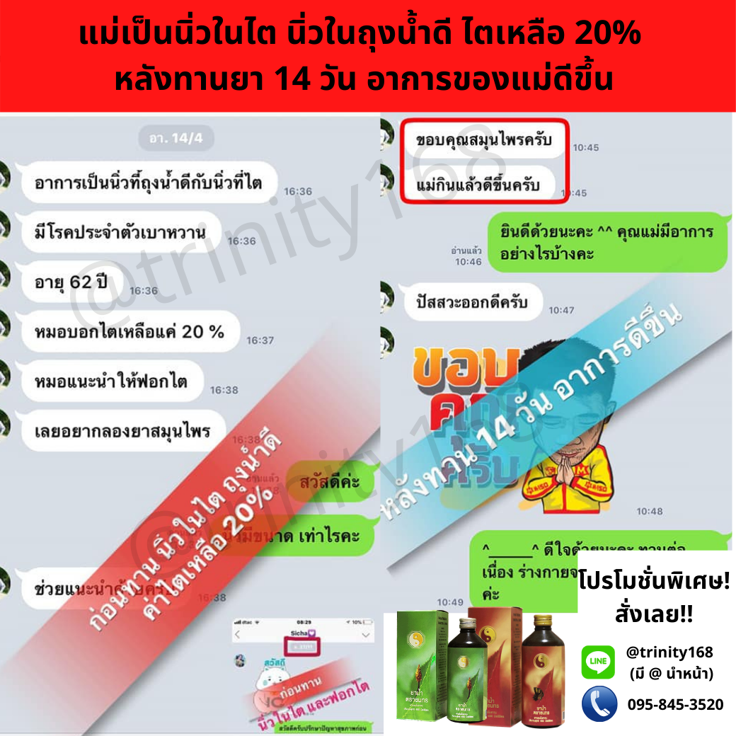 สลายนิ่วในไต