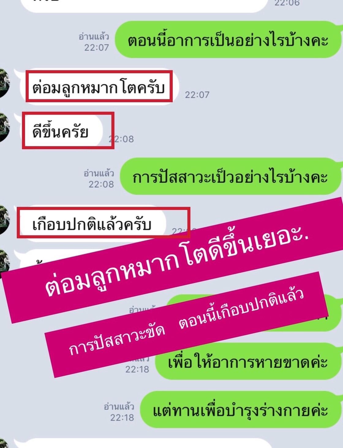 รักษาต่อมลูกหมากโต
