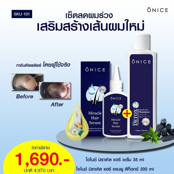 โปร 1 แถม 1 ลดผมร่วง เพิ่มผมหนา เซรั่ม 35ml. ฟรี! แชมพูดีท็อกซ์ 1 ขวด (ONICE โอไนซ์)