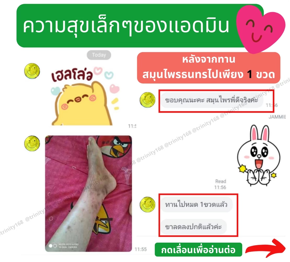 อาการเท้าบวม