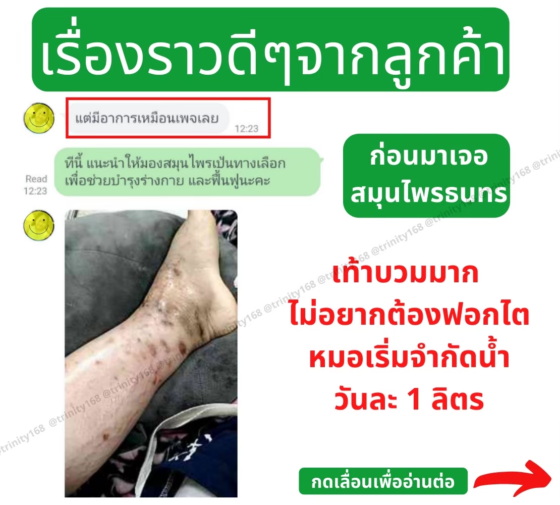เท้าบวมเกิดจาก
