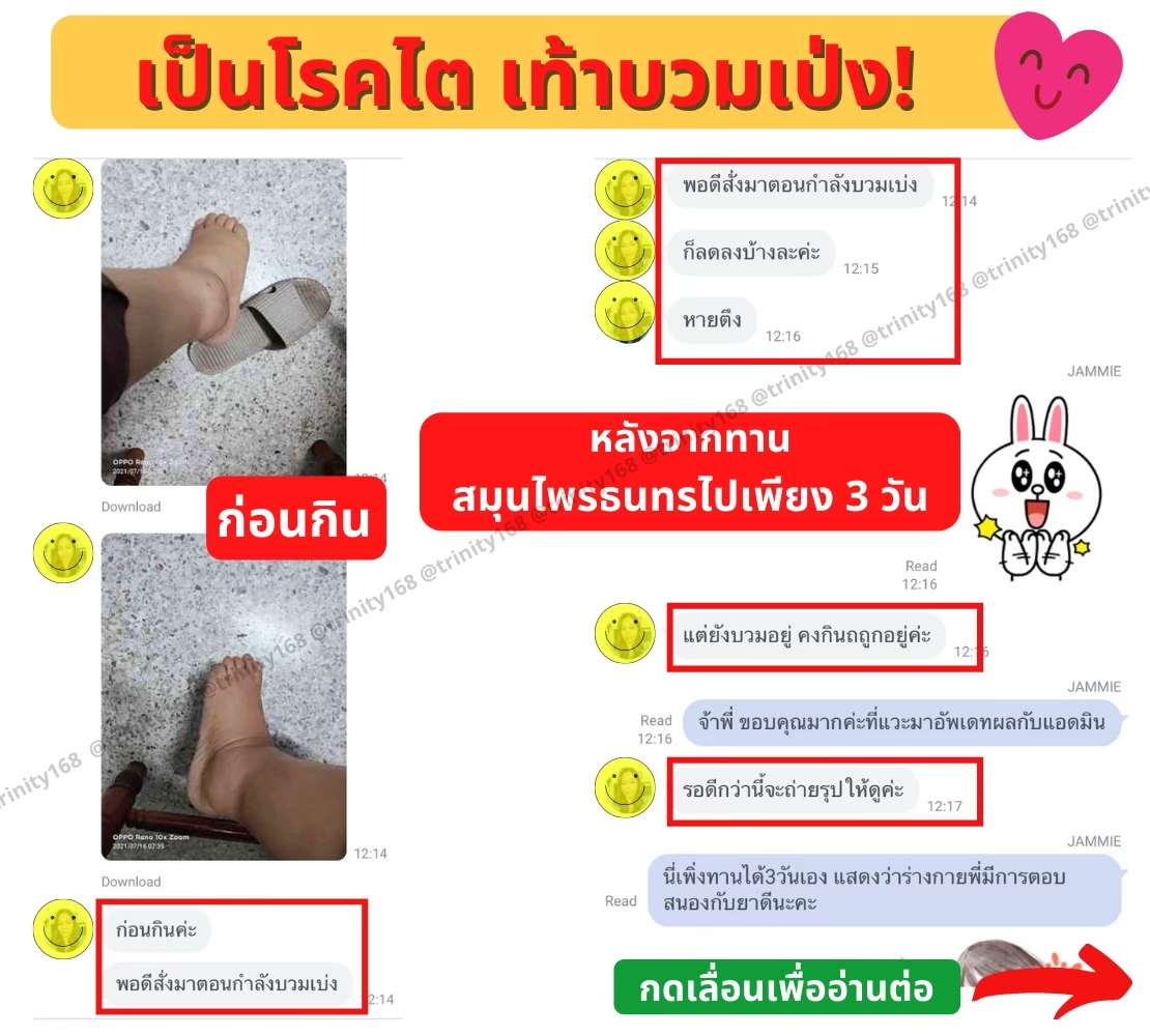 เท้าบวม โรคไต