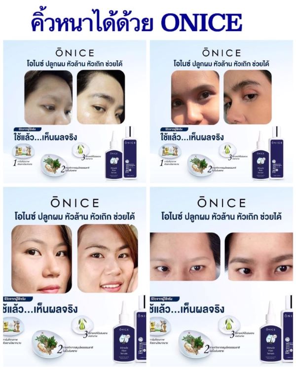 เซรั่มปลูกผม คิ้ว หนวด ขนาด 10ml. ONICE
