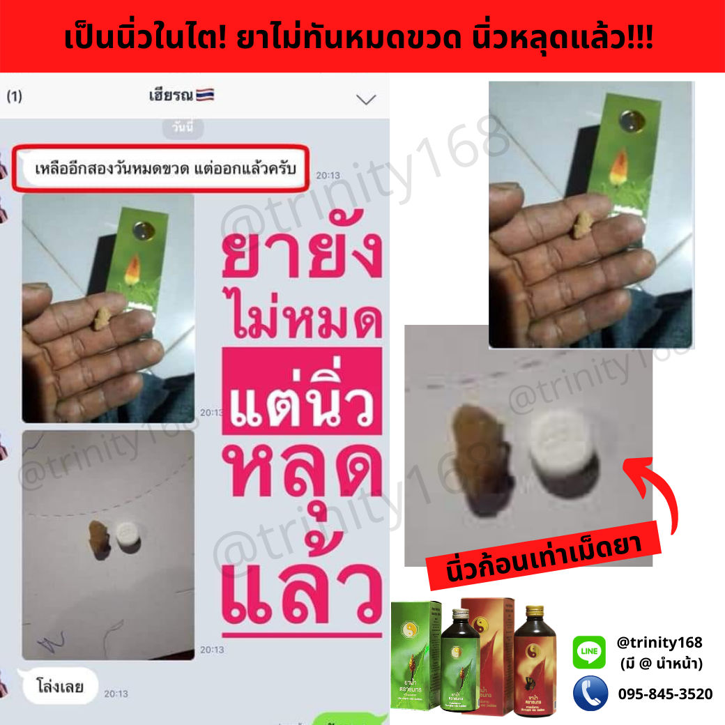 ศูนย์สลายนิ่วโรงพยาบาลศิริราช