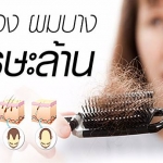 ปัญหาผมหลุดร่วง ผมบาง