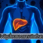 โรคตับแข็ง เกิดขึ้นได้ยังงัย แล้วจะรักษายังงัยดี ?